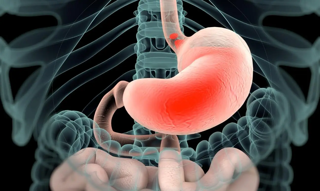 Prova questi cibi insoliti per uno stomaco di ferro: ecco il trucco della nonna